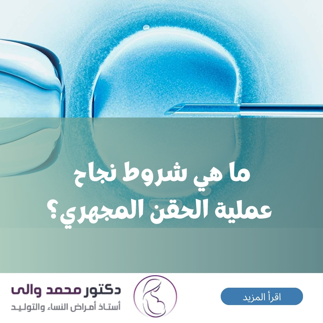 ما هي شروط نجاح عملية الحقن المجهري