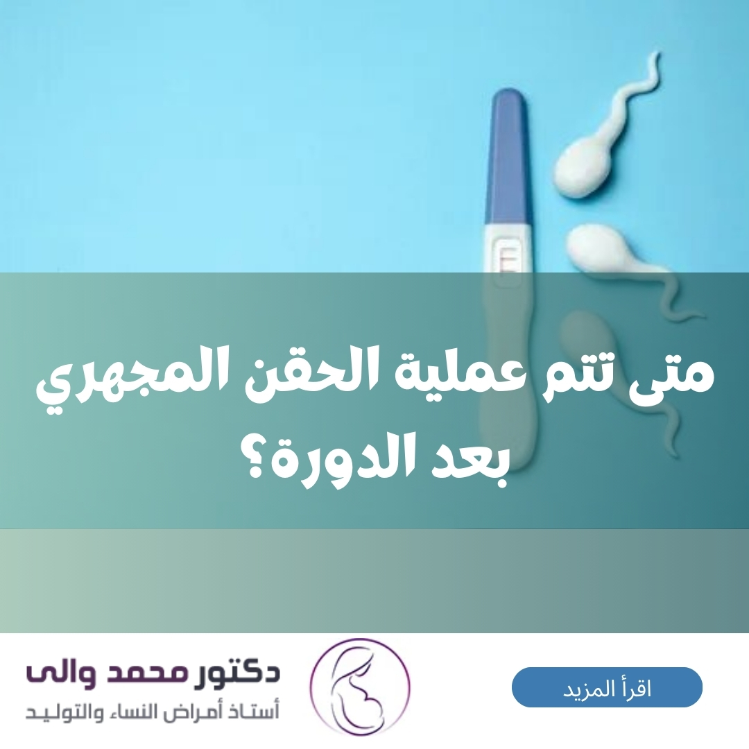 متى تتم عملية الحقن المجهري بعد الدورة