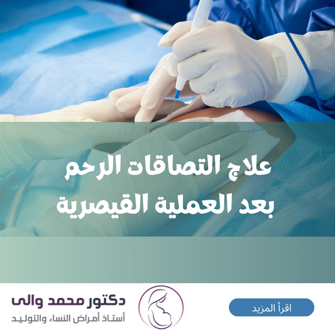 علاج التصاقات الرحم بعد العملية القيصرية