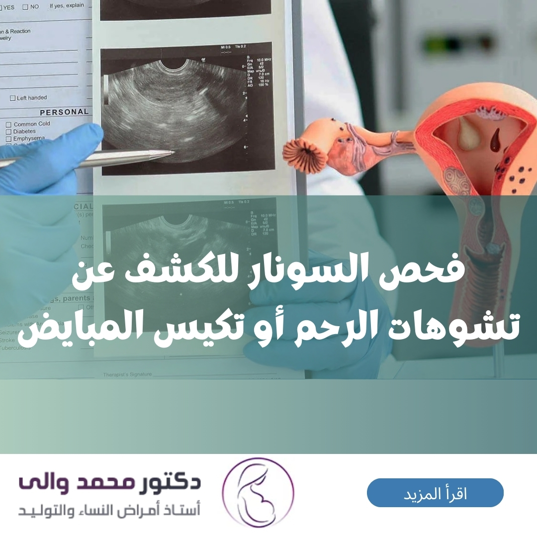 فحص السونار للكشف عن تشوهات الرحم أو تكيس المبايض