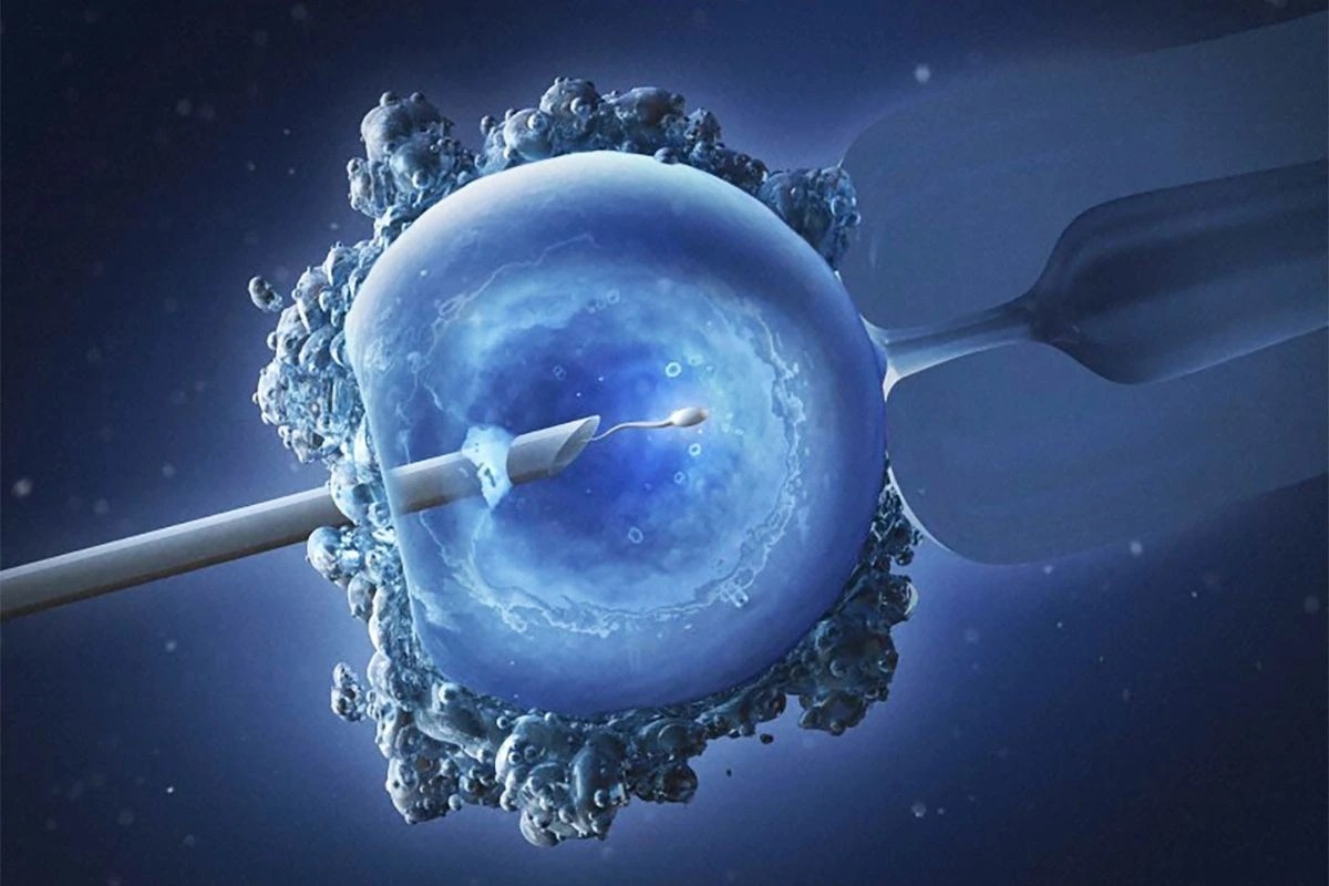 كم تستغرق عملية الحقن المجهري