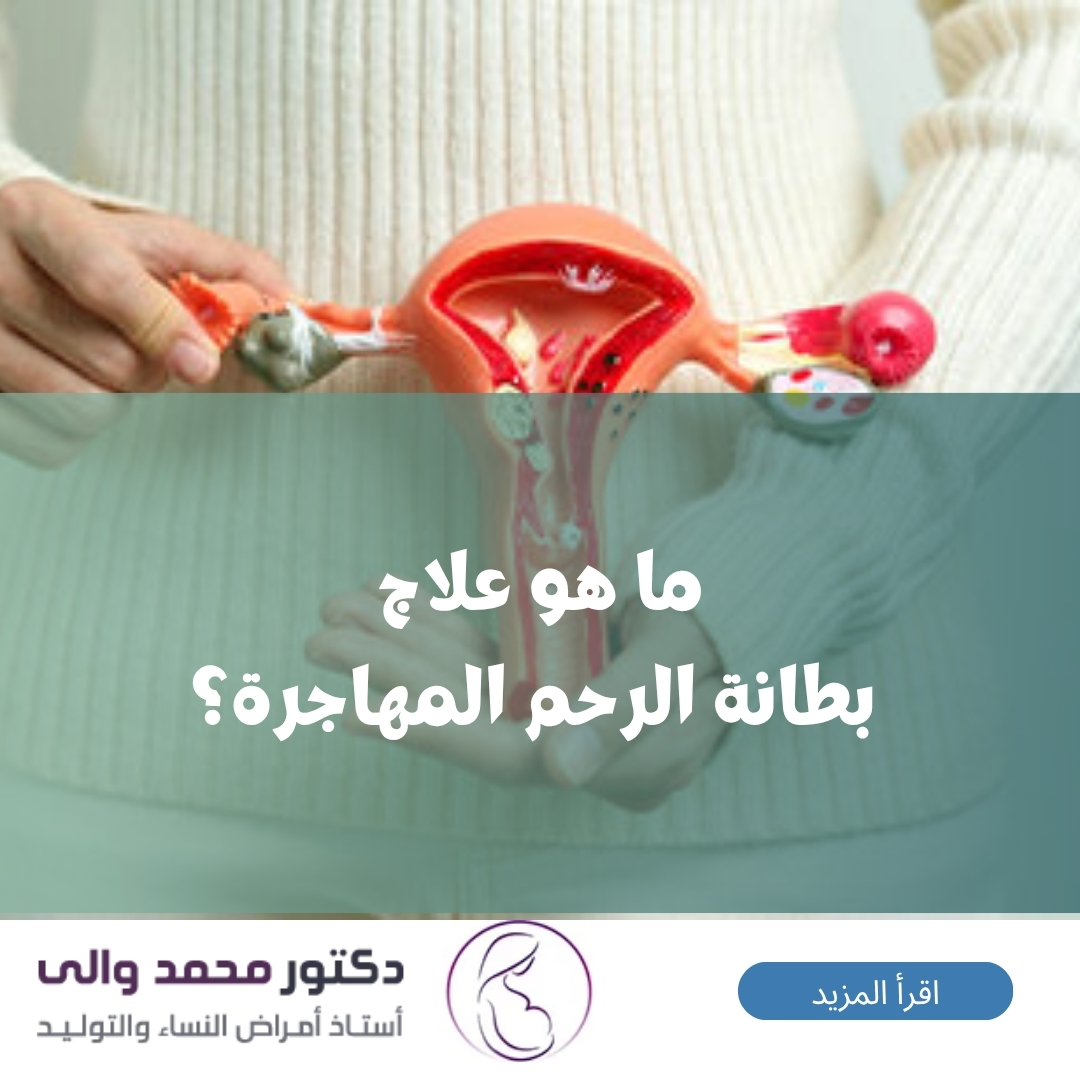 علاج بطانة الرحم المهاجرة