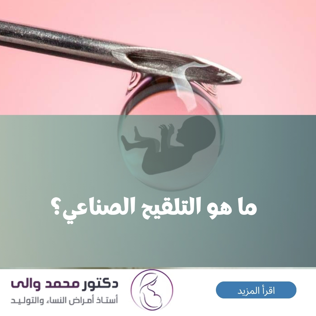 ما هو التلقيح الصناعي