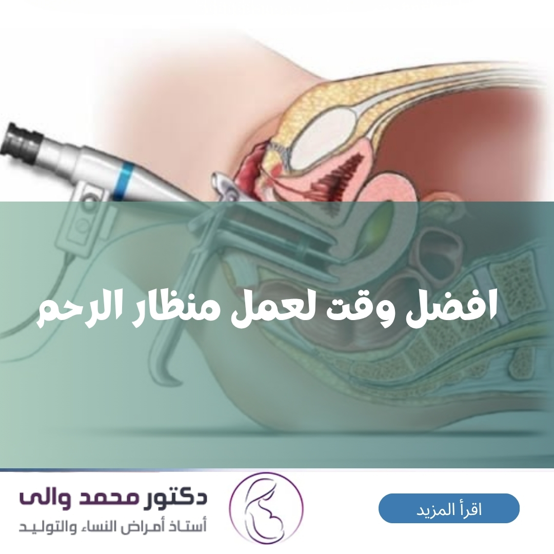 افضل وقت لعمل منظار الرحم