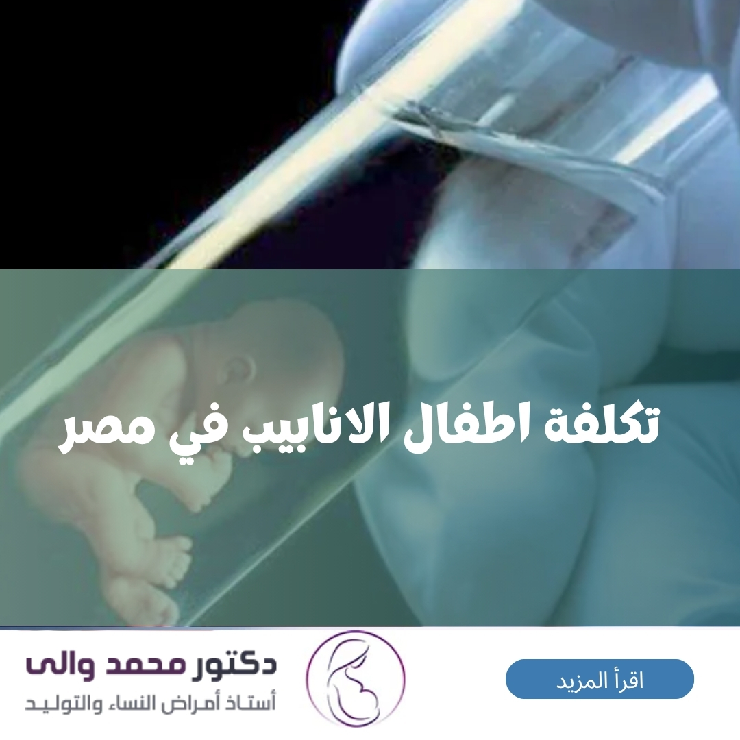 تكلفة اطفال الانابيب في مصر