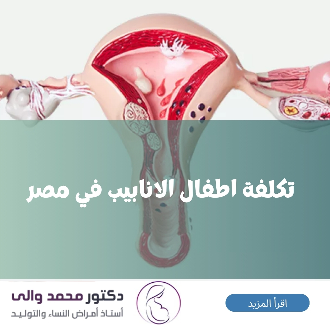 علاج الزوائد اللحمية في الرحم