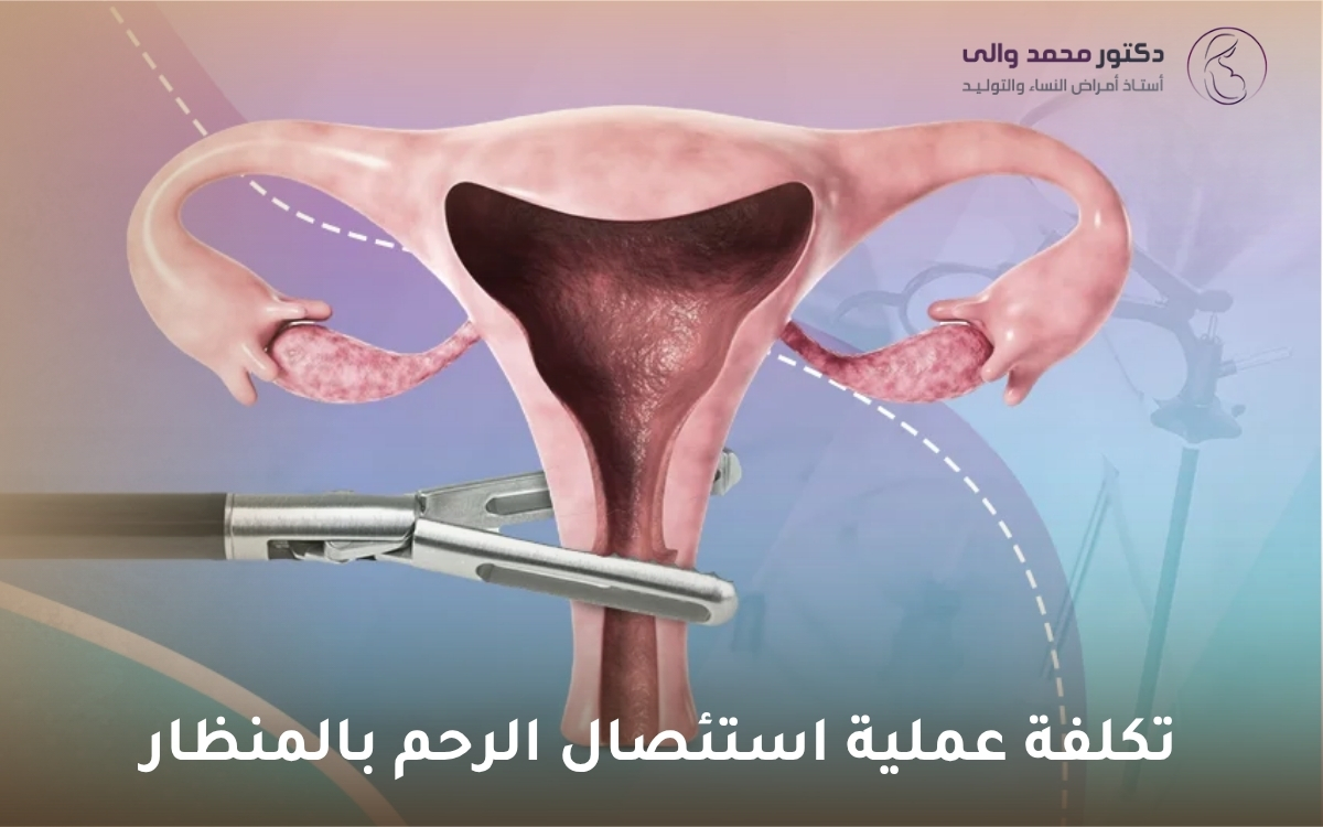 تكلفة عملية استئصال الرحم بالمنظار تكلفة عملية استئصال الرحم بالمنظار