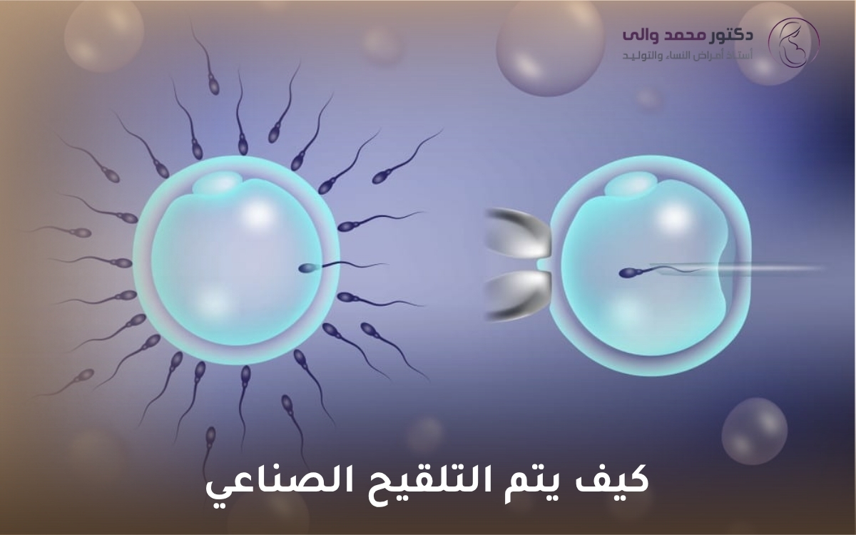 كيف يتم التلقيح الصناعي كيف يتم التلقيح الصناعي