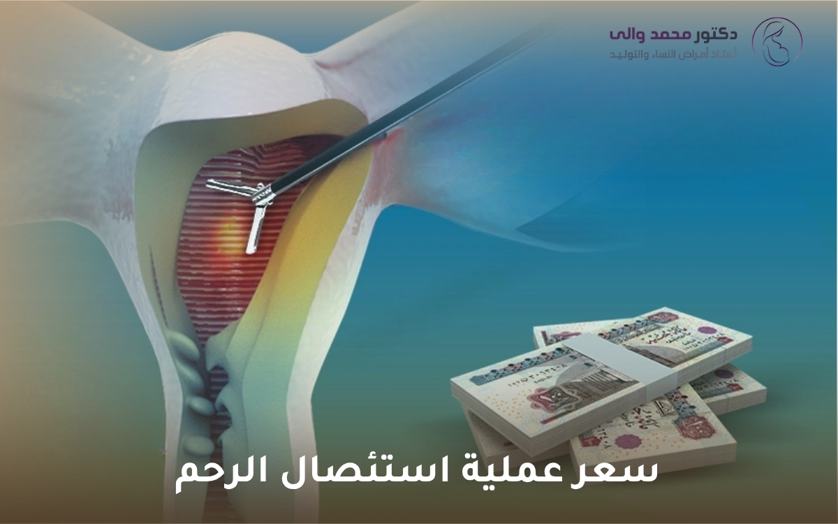سعر عملية استئصال الرحم