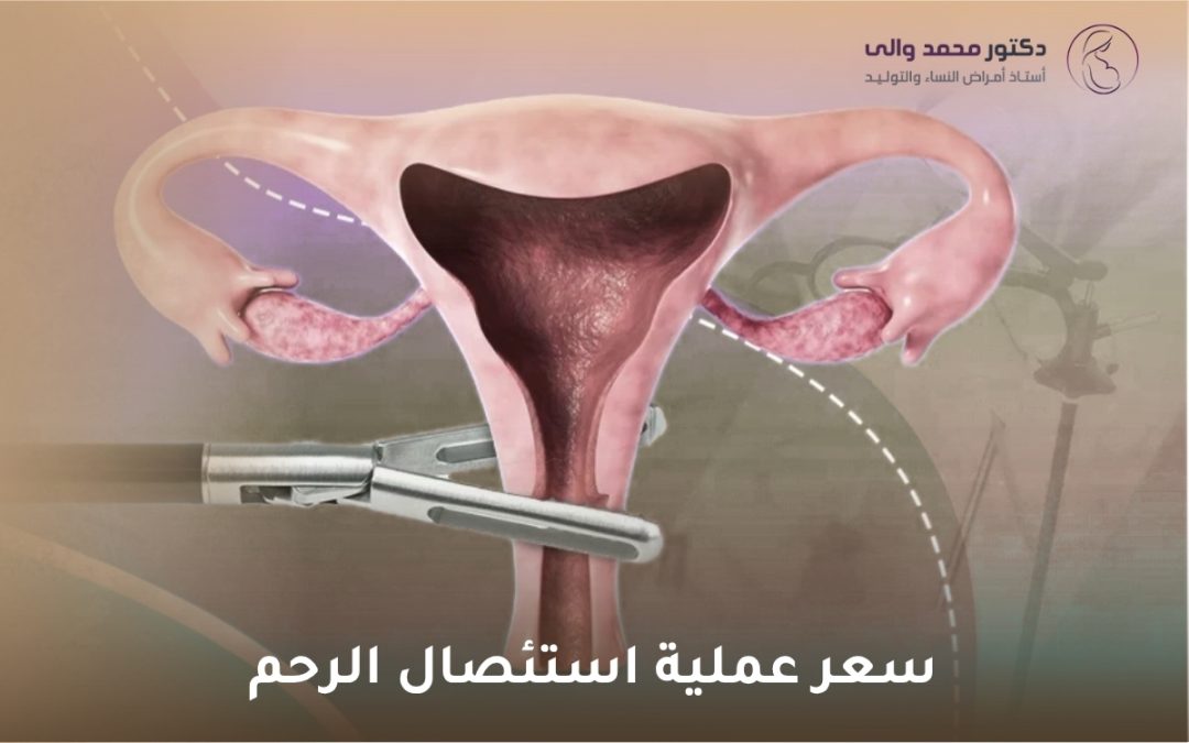 سعر عملية استئصال الرحم