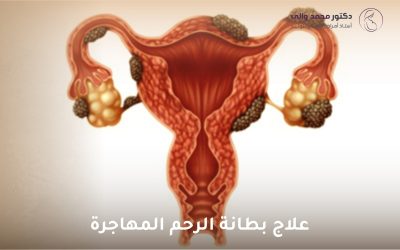 علاج بطانة الرحم المهاجرة: دليل شامل للتشخيص والعلاج والتعايش