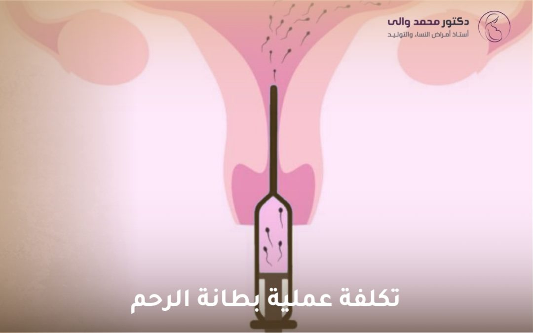 تكلفة عملية بطانة الرحم