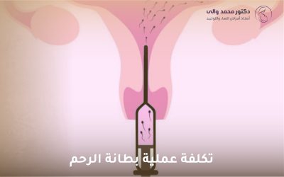 تكلفة عملية بطانة الرحم: دليل شامل للمريضات