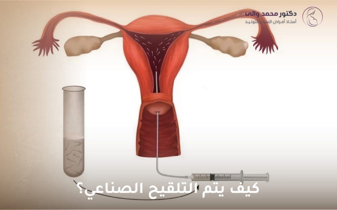كيف يتم التلقيح الصناعي