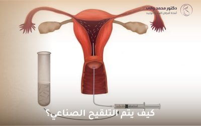 كيف يتم التلقيح الصناعي: دليل شامل من د. محمد والي