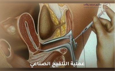 عملية التلقيح الصناعي: دليل شامل لتحقيق حلم الأمومة