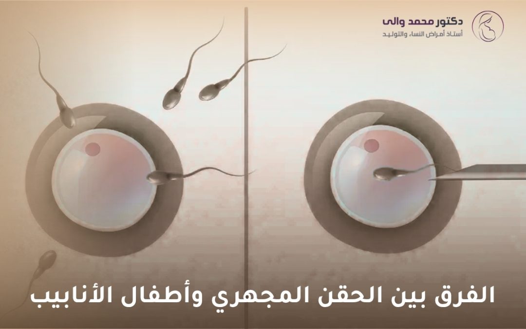 الفرق بين الحقن المجهري وأطفال الأنابيب