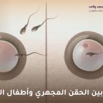 الفرق بين الحقن المجهري وأطفال الأنابيب
