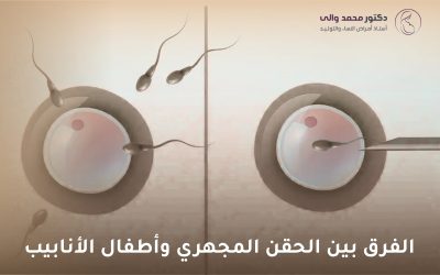 الفرق بين الحقن المجهري وأطفال الأنابيب: دليل شامل للأزواج