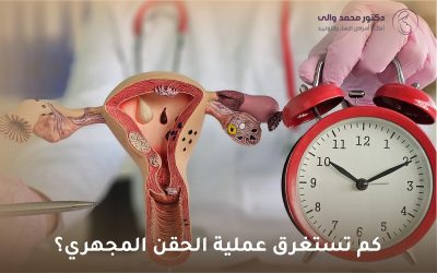كم تستغرق عملية الحقن المجهري؟ دليل شامل للأزواج