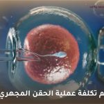 كم تكلفة عملية الحقن المجهري
