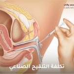 تكلفة التلقيح الصناعي