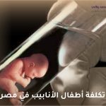 تكلفة أطفال الأنابيب في مصر