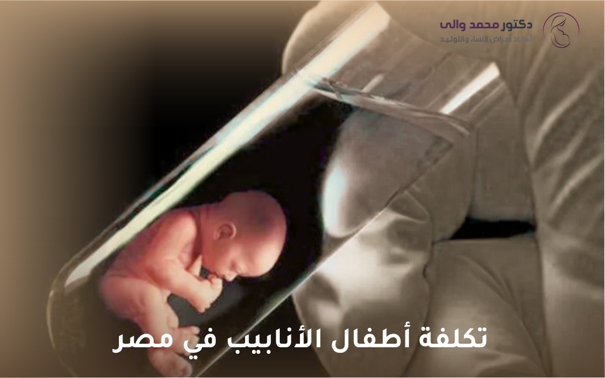 تكلفة أطفال الأنابيب في مصر تكلفة أطفال الأنابيب في مصر