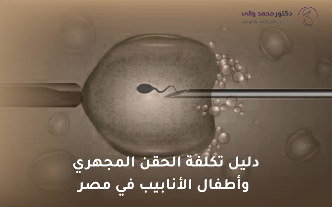 تكلفة الحقن المجهري وأطفال الأنابيب في مصر