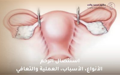 دليل استئصال الرحم: الأنواع والأسباب والعملية والتعافي