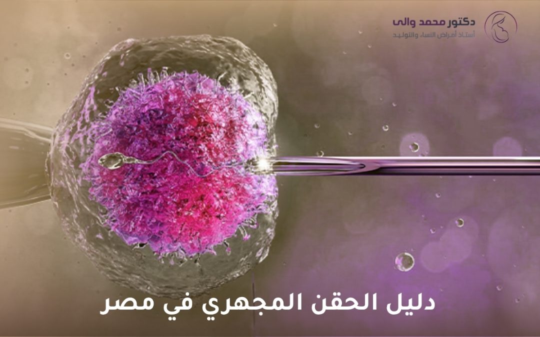 الحقن المجهري في مصر