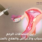 التصاقات الرحم