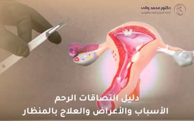 دليل التصاقات الرحم: الأسباب والأعراض والعلاج بالمنظار