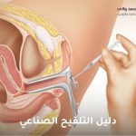 دليل التلقيح الصناعي