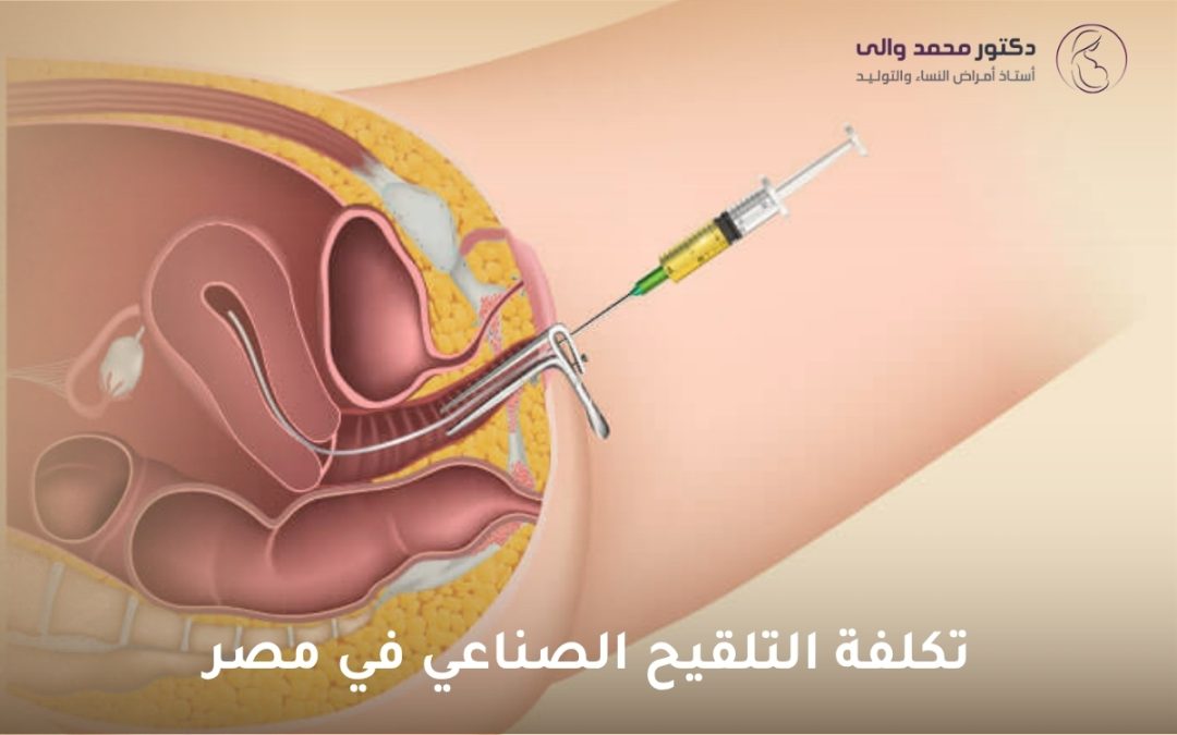 تكلفة التلقيح الصناعي في مصر