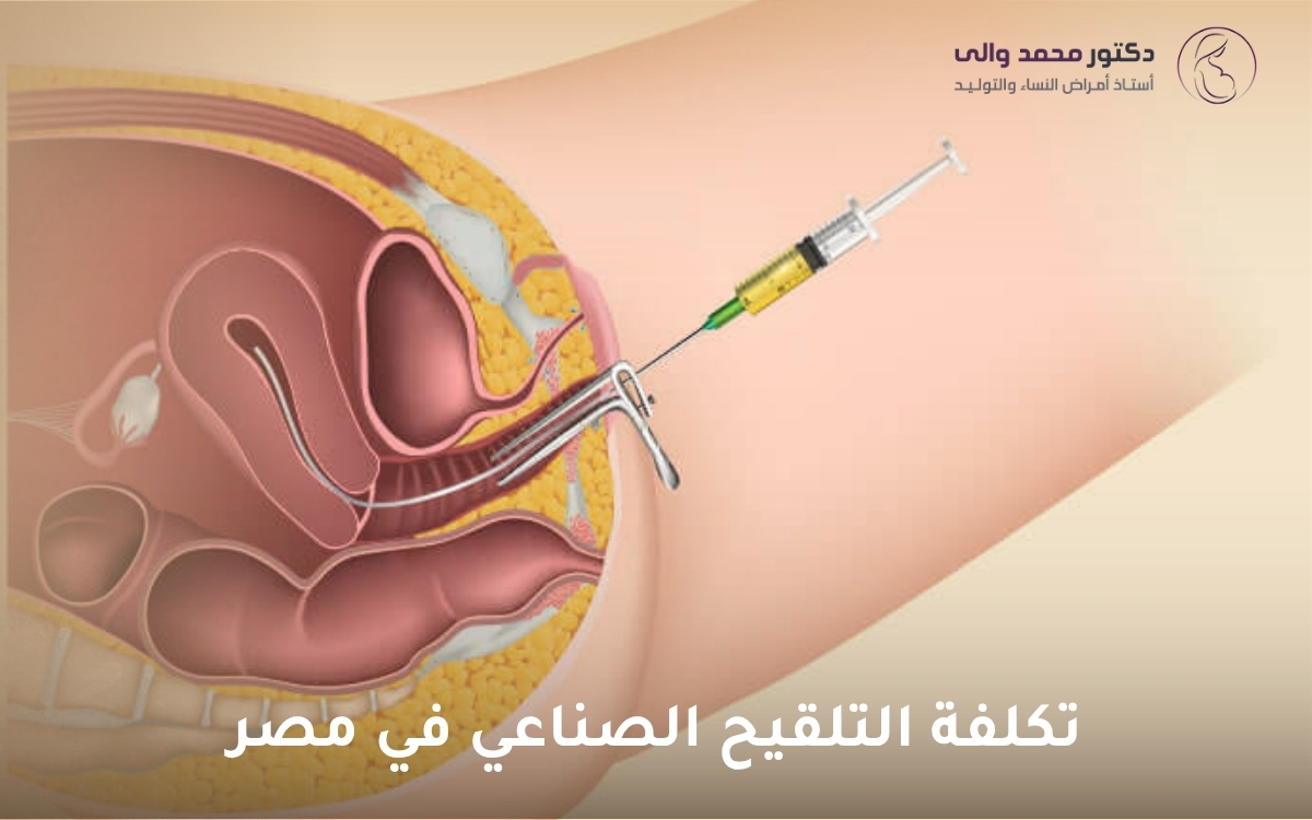تكلفة التلقيح الصناعي في مصر تكلفة التلقيح الصناعي في مصر