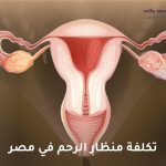 تكلفة منظار الرحم في مصر