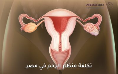 تكلفة منظار الرحم في مصر