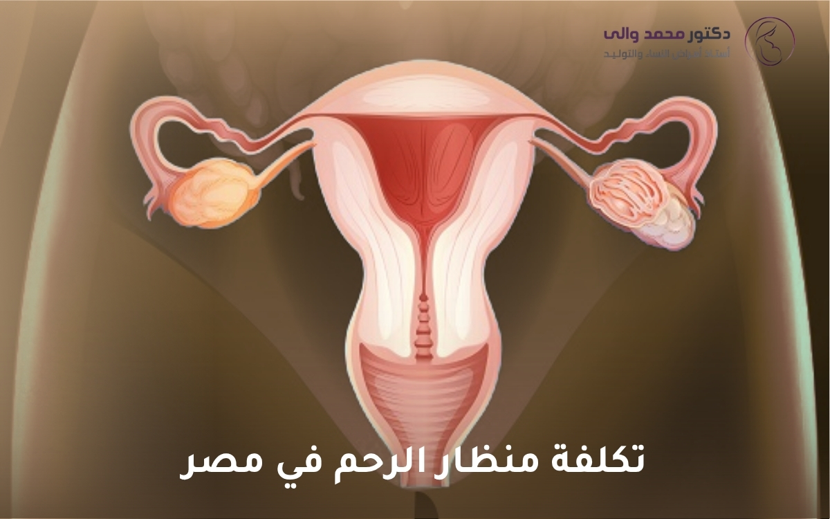 تكلفة منظار الرحم في مصر تكلفة منظار الرحم في مصر