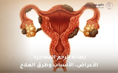 بطانة الرحم المهاجرة: الأعراض، الأسباب وطرق العلاج