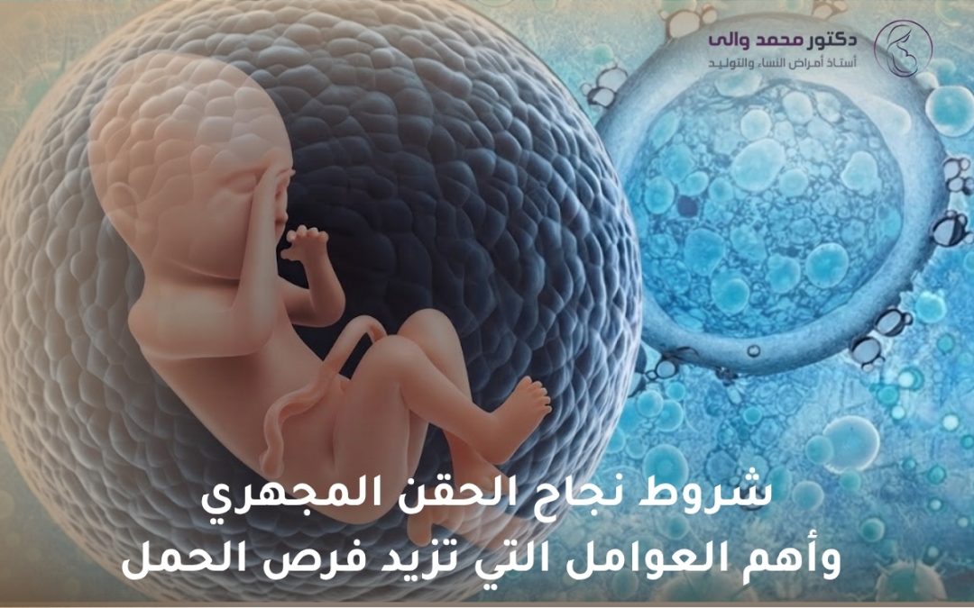 شروط نجاح الحقن المجهري