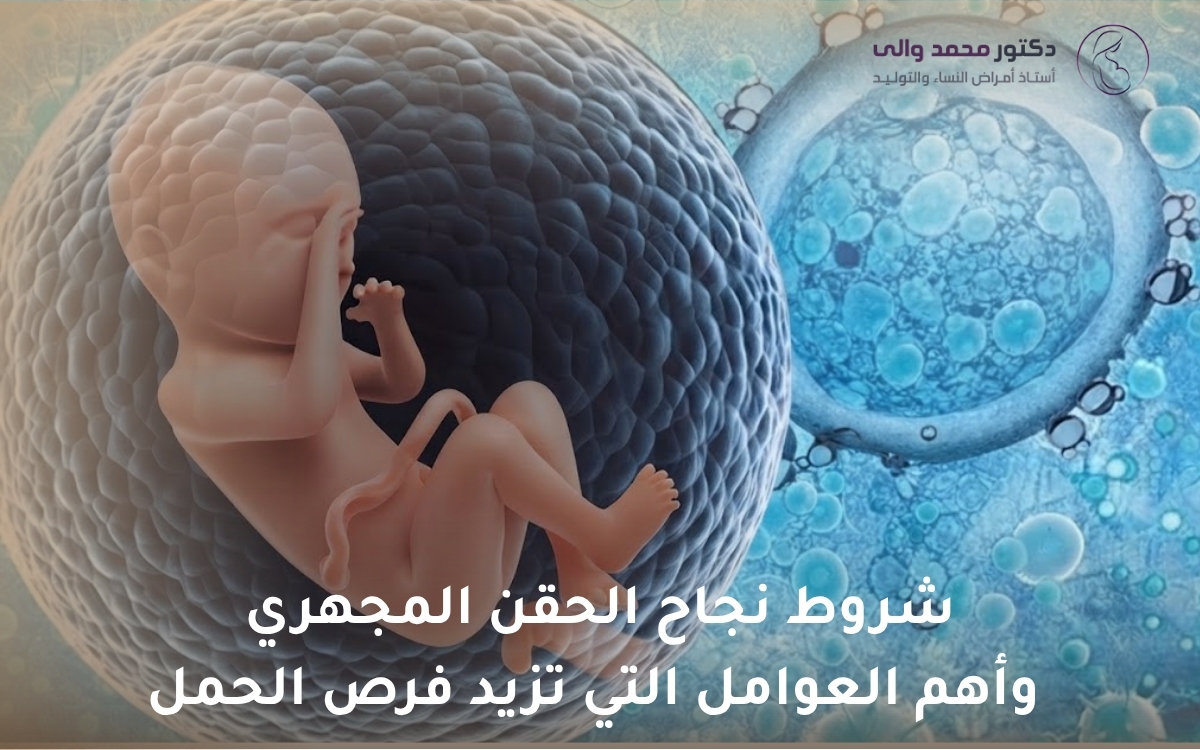 شروط نجاح الحقن المجهري شروط نجاح الحقن المجهري