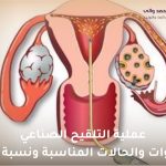 عملية التلقيح الصناعي
