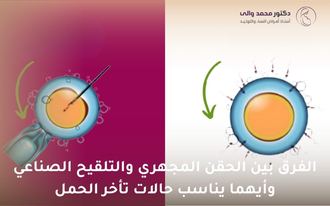 الفرق بين الحقن المجهري والتلقيح الصناعي