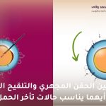 الفرق بين الحقن المجهري والتلقيح الصناعي