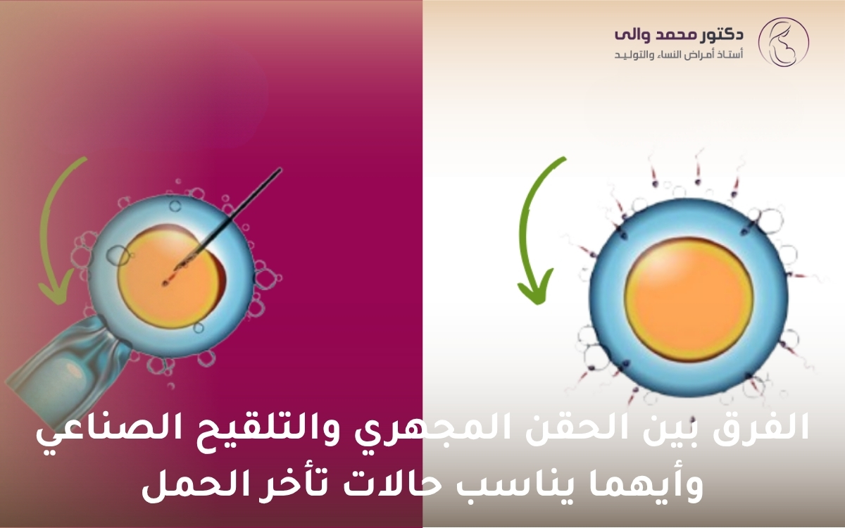 الفرق بين الحقن المجهري والتلقيح الصناعي الفرق بين الحقن المجهري والتلقيح الصناعي