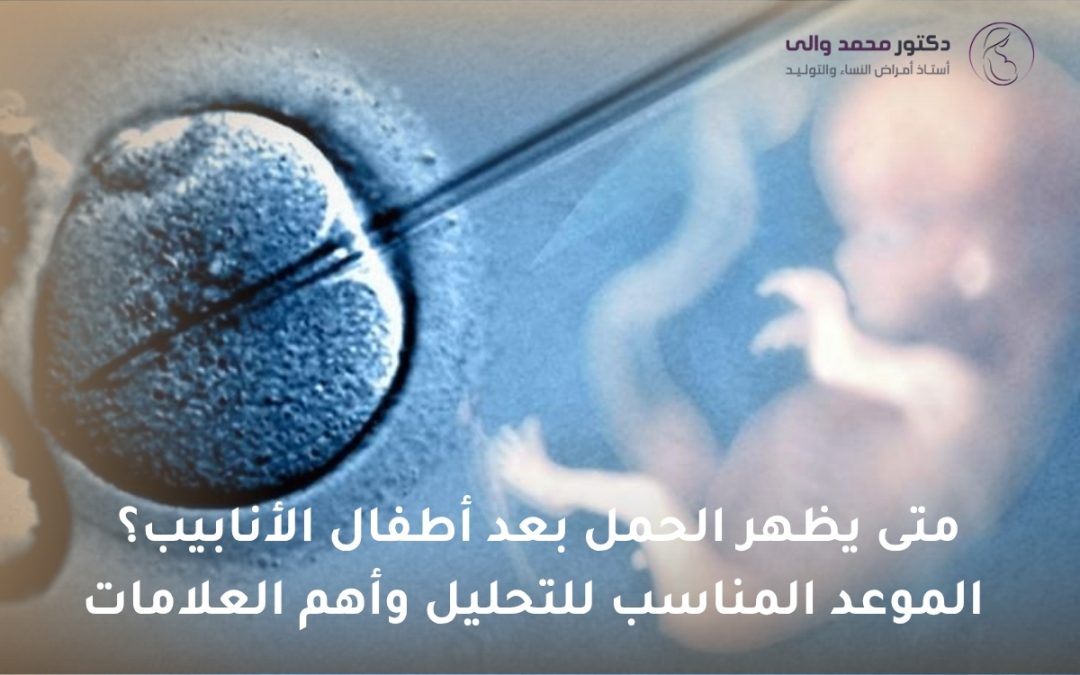 متى يظهر الحمل بعد أطفال الأنابيب